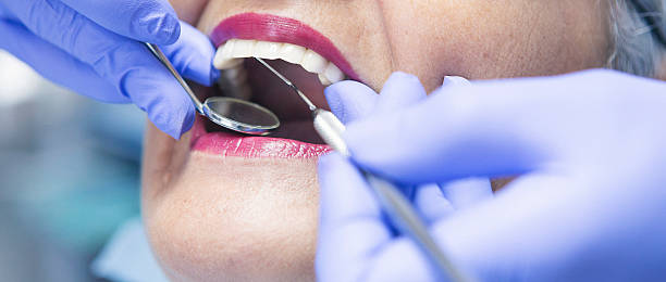 Best Emergency Dentist for Knocked-Out Tooth in Samoset, FL